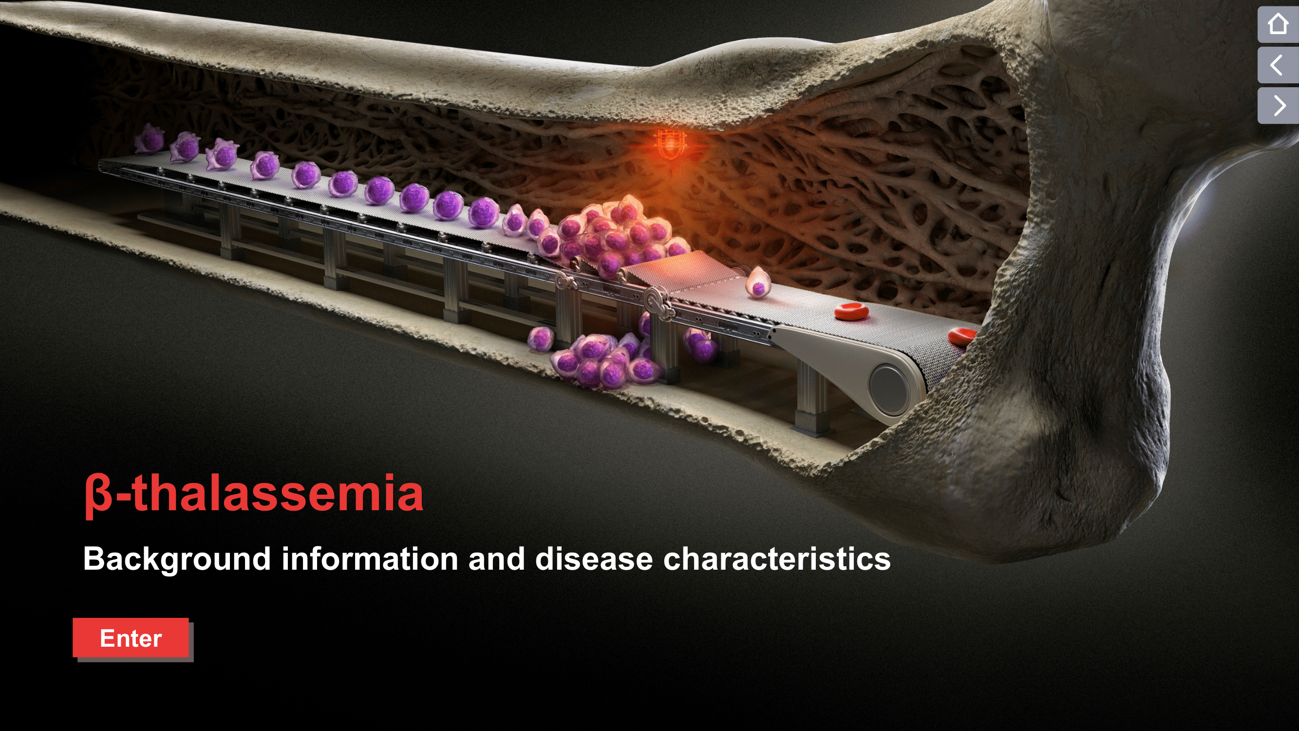 Thalassemia